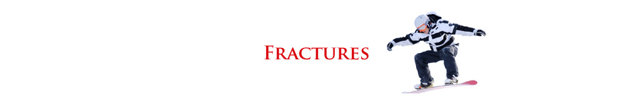 Birmingham Orthopedic Foot and Ankle Clinic - Calcaneal Fractures